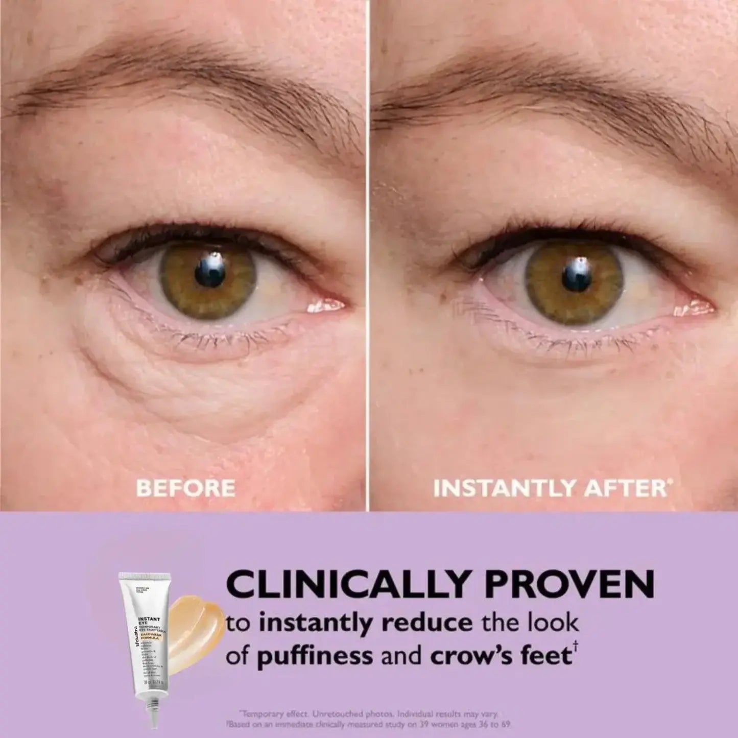 EyeLustra™ - For lifted, refreshed & youthful eyes