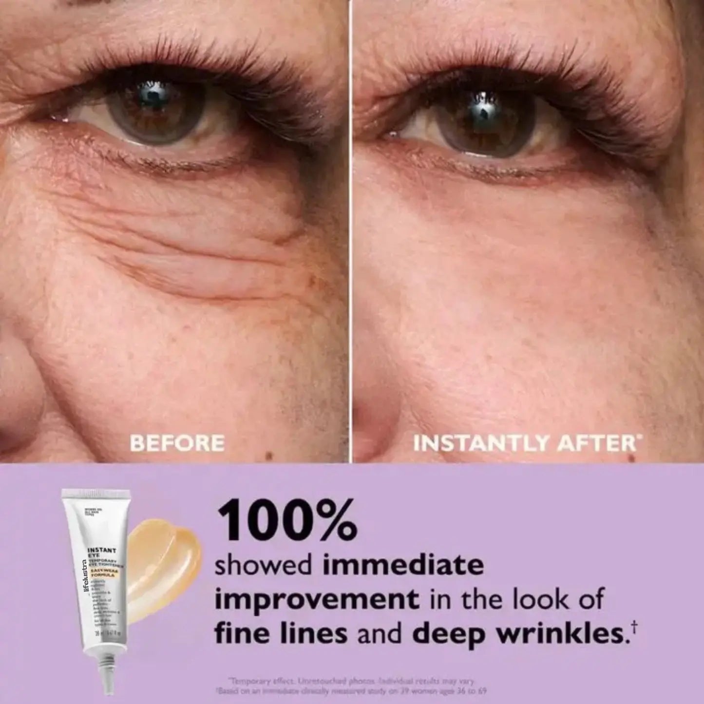 EyeLustra™ - For lifted, refreshed & youthful eyes