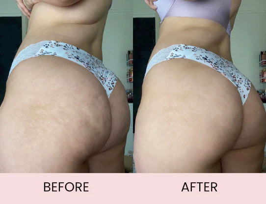 Anti-Cellulite Massage Oil