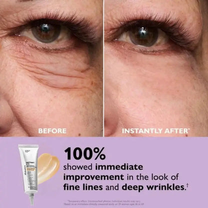 EyeLustra™ - For lifted, refreshed & youthful eyes