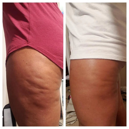 Anti-Cellulite Massage Oil